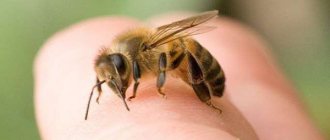 аллергия на укус пчелы