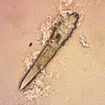 Клещ Demоdex canis под микроскопом при увеличении в 400 раз