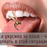 Насколько опасен укус осы в ткани языка
