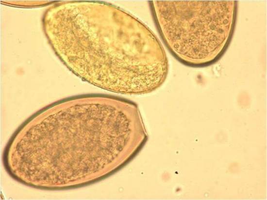 Яйца глистов под микроскопом